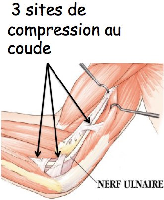 la compression du nerf ulnaire ( ou est responsable de et de troubles de la ( fourmies, douleurs) de